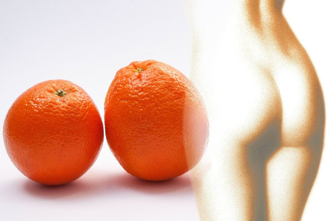 Combattere la cellulite